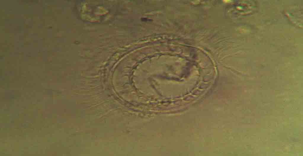 vorticella?
